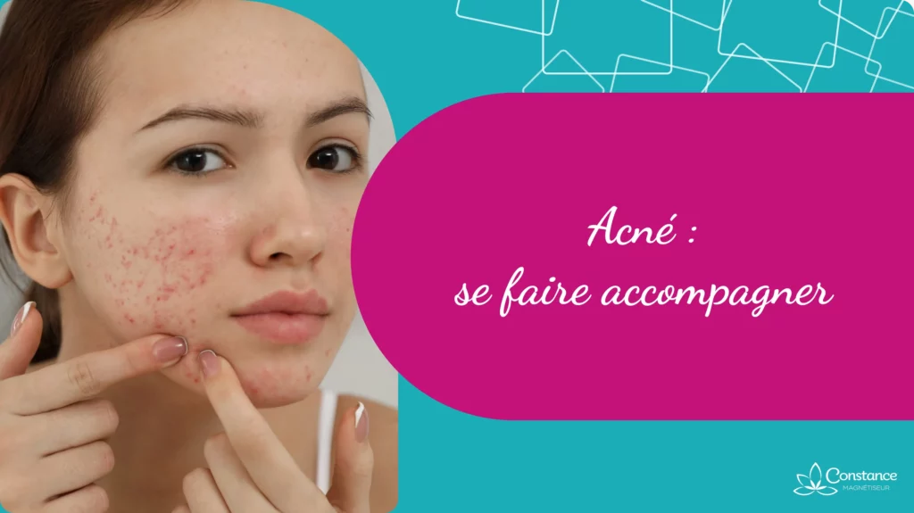 Acné_ Se faire accompagner