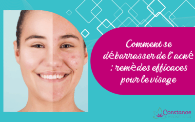 Comment se débarrasser de l’acné : remèdes efficaces pour le visage